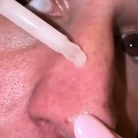 Peel Shot Glow Reis Ampulle Duo von Wowgood